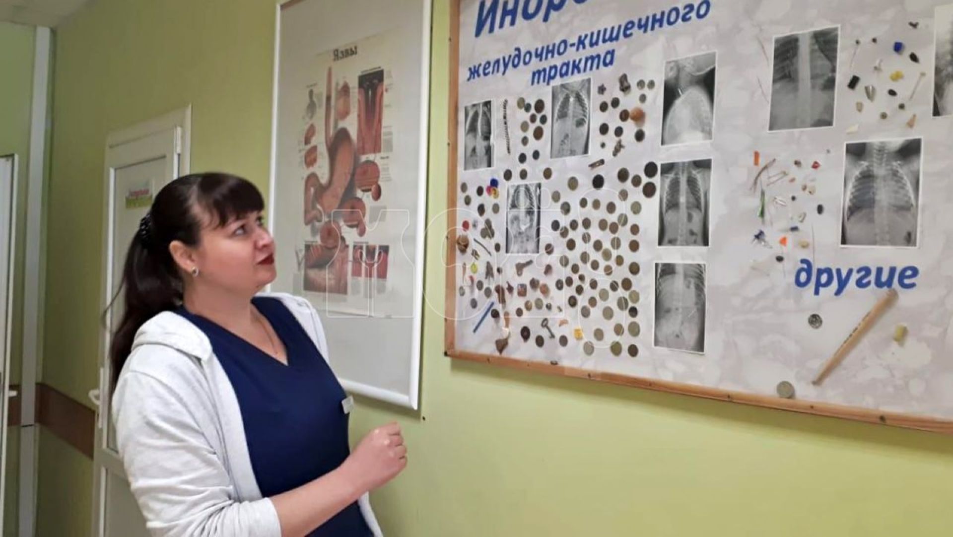 15 детей попали в воронежскую больницу, проглотив инородные предметы&nbsp;
