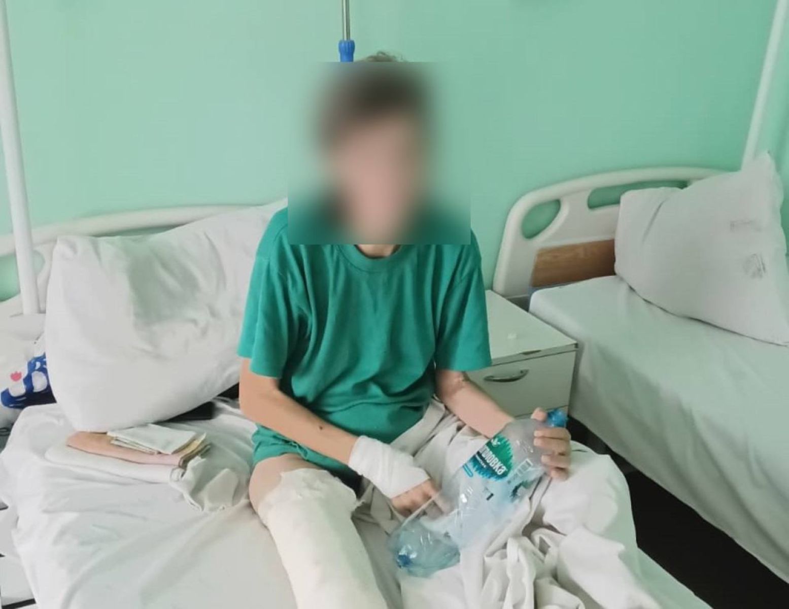 Мужчина сломал ногу сожительнице в&nbsp;Воронеже