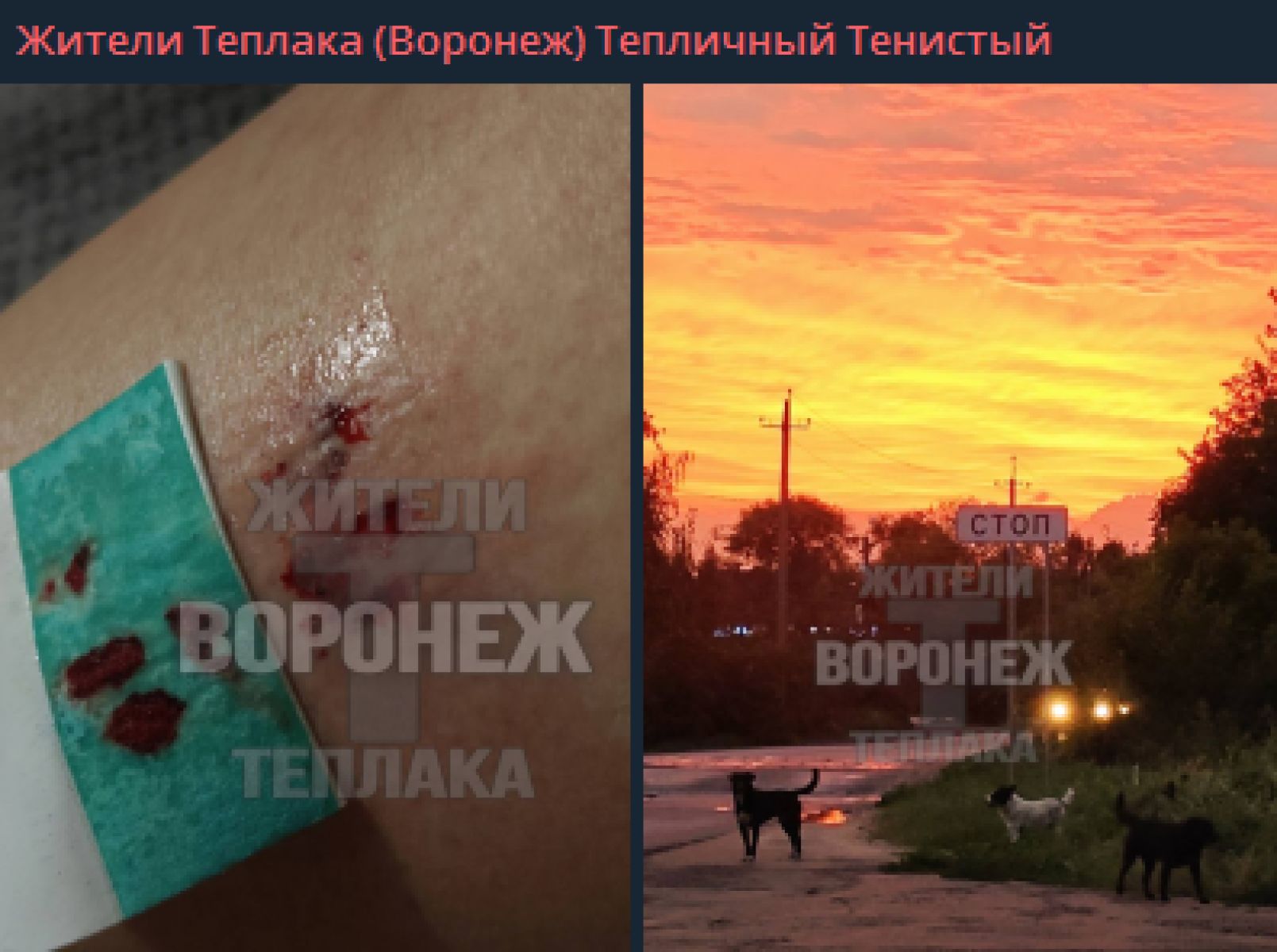 Стая собак искусала воронежанку по дороге домой&nbsp;