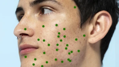 Инфекционист рассказал, почему ветрянка смертельно опасна для взрослых