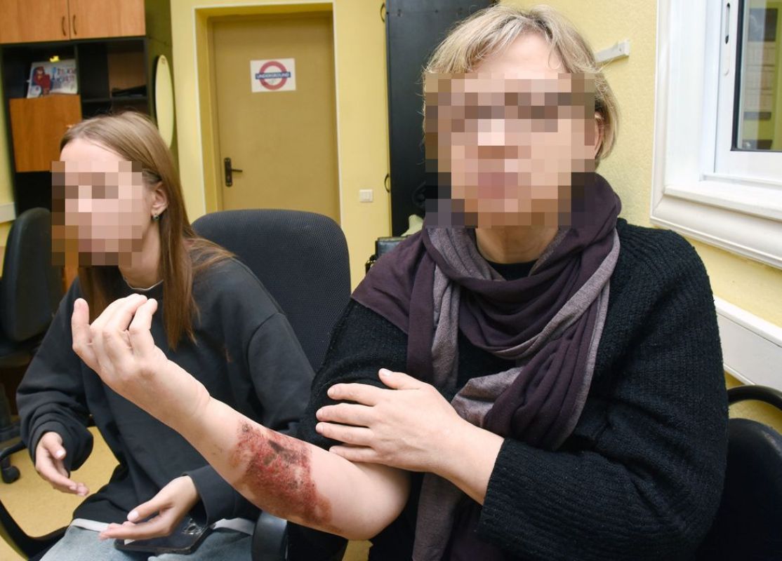 Дочь женщины, когда ехала к матери, думала, что у той обычный синяк, а когда увидела её руку, была просто в ужасе!