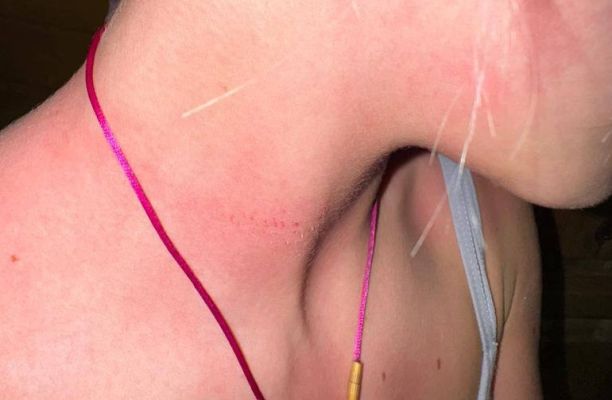 «Кулаком в живот». Фото и видео избиения воронежской фигуристки матерью показала Яна Рудковская