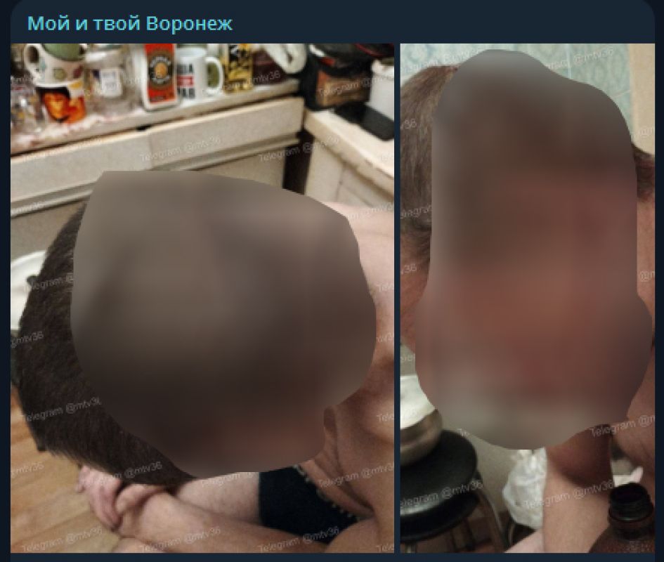 Воронежцы: дети разбили голову мужчине&nbsp;