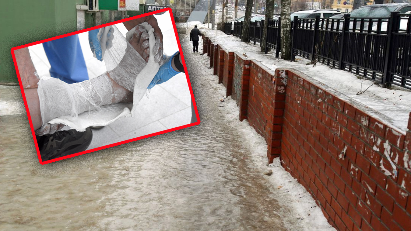 Воронежцы ступили на скользкую дорожку