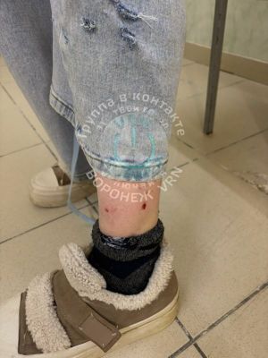 Искусавших воронежанку собак ловят уже неделю