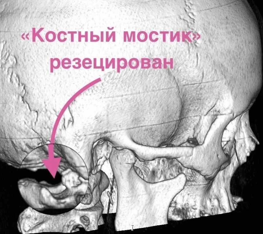 Хирурги спасли воронежанку, страдавшую 15 лет от&nbsp;адских болей
