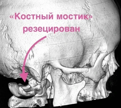 Хирурги спасли воронежанку, страдавшую 15 лет от адских болей