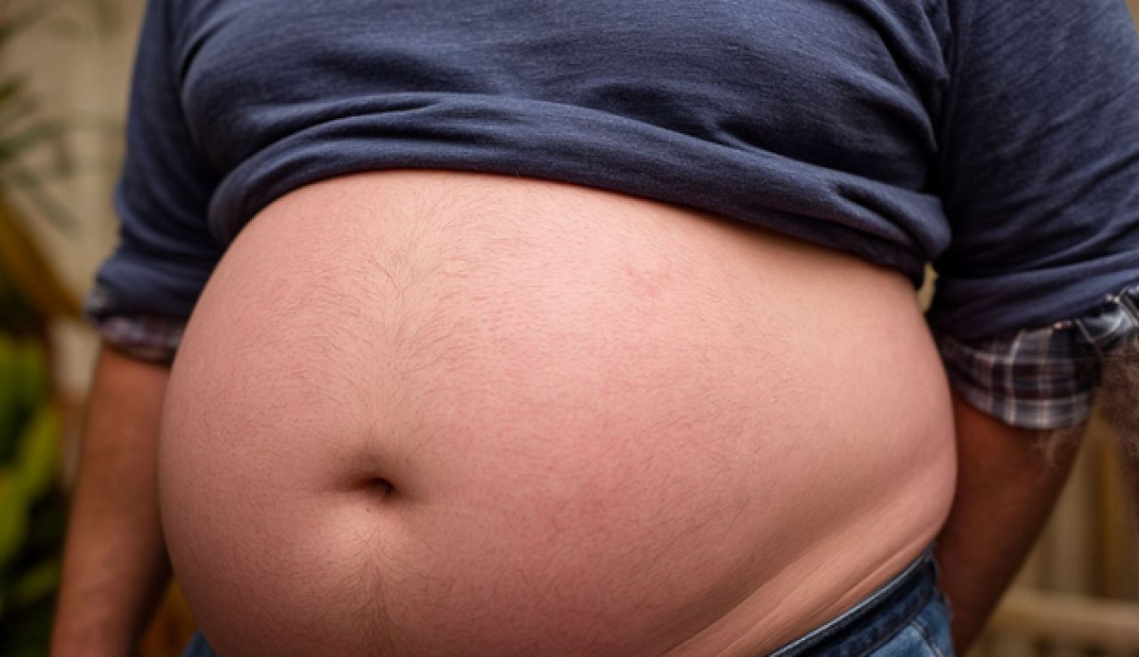 Минздрав назвал главный признак опасного ожирения у&nbsp;мужчин