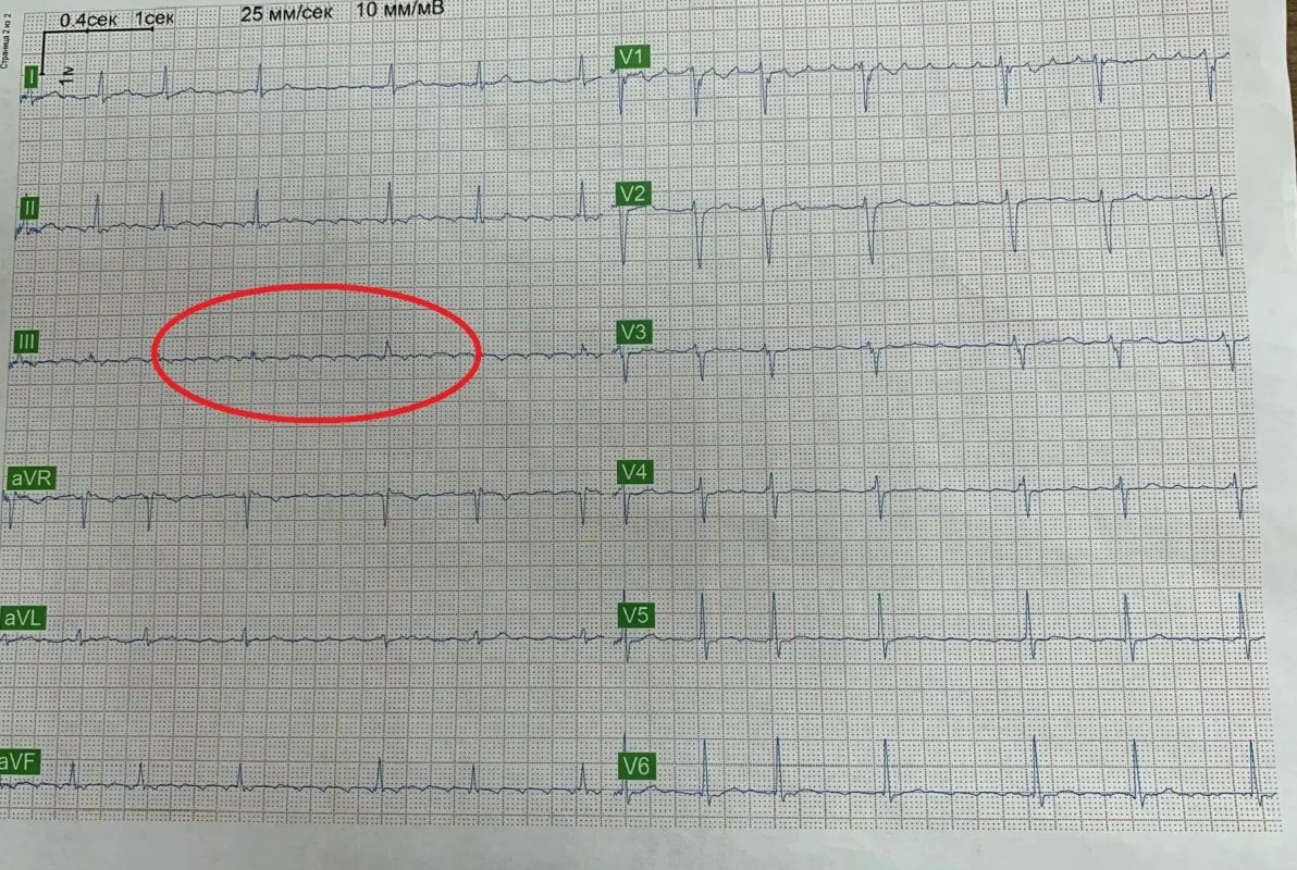 Любовь спасла жизнь воронежцу: романтичная история из&nbsp;отделения кардиологии