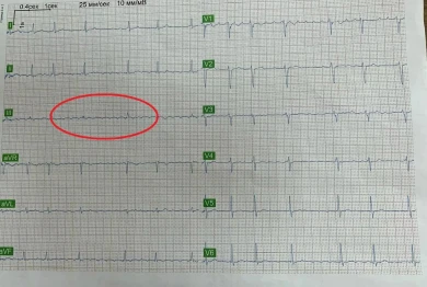 Любовь спасла жизнь воронежцу: романтичная история из отделения кардиологии