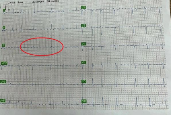 Любовь спасла жизнь воронежцу: романтичная история из отделения кардиологии