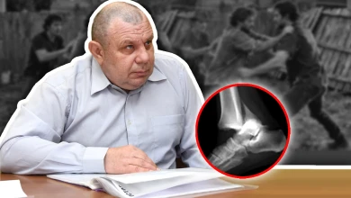 «В ногу вставили винт». Почему год не возбуждают уголовное дело после жуткого избиения воронежца