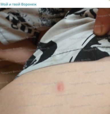 В полиции прокомментировали стрельбу из страйкбольного оружия по ребёнку в Воронеже