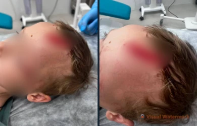 «Хозяин смотрел, как собака пытается убить ребёнка». Пёс напал на маленького внука Дарьи Донцовой