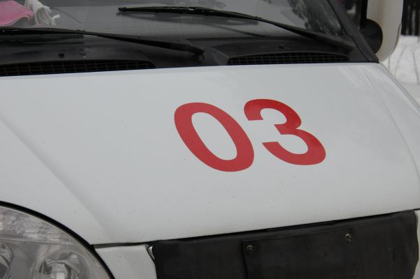Фаланги пяти пальцев срезало пилой рабочему воронежского завода