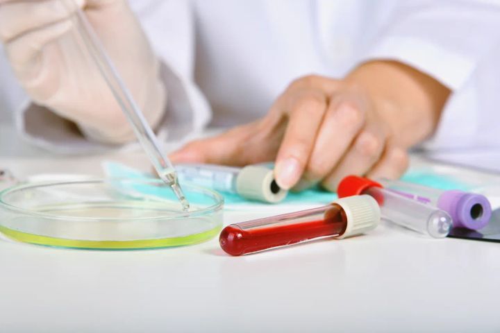Это может указывать на повышенный холестерин - руки расскажут